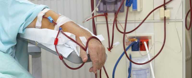 Kidney Dialysis Lawsuit