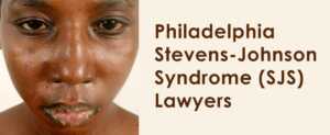 Philadelphia Stevens-Johnson Syndrome (SJS) Lawyers